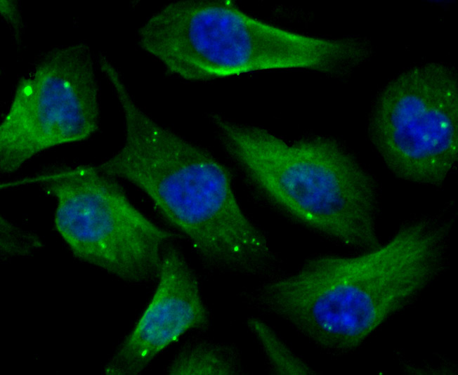 ICC staining Cellular Apoptosis Susceptibility in PC-3M cells (green). The nuclear counter stain is DAPI (blue). Cells were fixed in paraformaldehyde, permeabilised with 0.25% Triton X100/PBS.