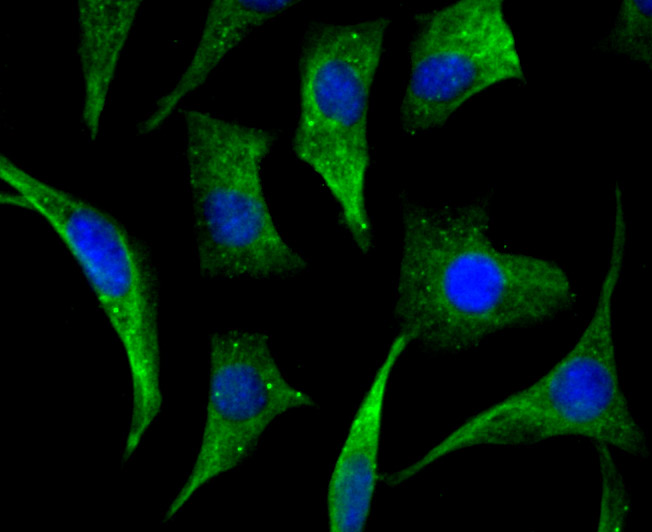 ICC staining Cellular Apoptosis Susceptibility in SH-SY5Y cells (green). The nuclear counter stain is DAPI (blue). Cells were fixed in paraformaldehyde, permeabilised with 0.25% Triton X100/PBS.