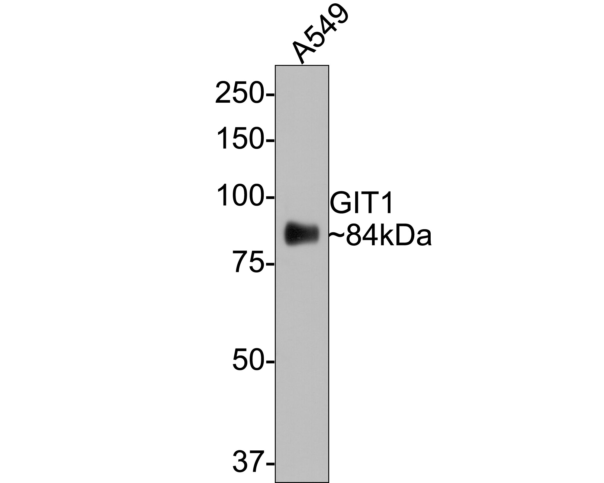 Western blot analysis of GIT1 on A549 cell lysates with Rabbit anti-GIT1 antibody (ET7106-91) at 1/500 dilution.<br />
<br />
Lysates/proteins at 10 µg/Lane.<br />
<br />
Predicted band size: 84 kDa<br />
Observed band size: 84 kDa<br />
<br />
Exposure time: 2 minutes;<br />
<br />
8% SDS-PAGE gel.<br />
<br />
Proteins were transferred to a PVDF membrane and blocked with 5% NFDM/TBST for 1 hour at room temperature. The primary antibody (ET7106-91) at 1/500 dilution was used in 5% NFDM/TBST at room temperature for 2 hours. Goat Anti-Rabbit IgG - HRP Secondary Antibody (HA1001) at 1:200,000 dilution was used for 1 hour at room temperature.