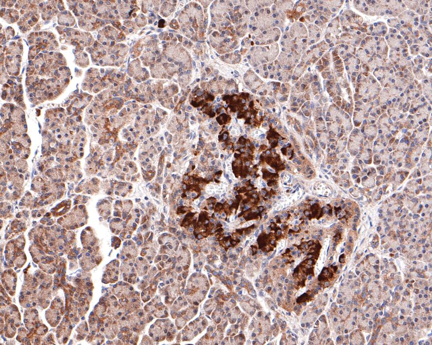 Immunohistochemical analysis of paraffin-embedded human pancreas tissue with Rabbit anti-GIT1 antibody (ET7106-91) at 1/400 dilution.<br />
<br />
The section was pre-treated using heat mediated antigen retrieval with Tris-EDTA buffer (pH 9.0) for 20 minutes. The tissues were blocked in 1% BSA for 20 minutes at room temperature, washed with ddH2O and PBS, and then probed with the primary antibody (ET7106-91) at 1/400 dilution for 1 hour at room temperature. The detection was performed using an HRP conjugated compact polymer system. DAB was used as the chromogen. Tissues were counterstained with hematoxylin and mounted with DPX.