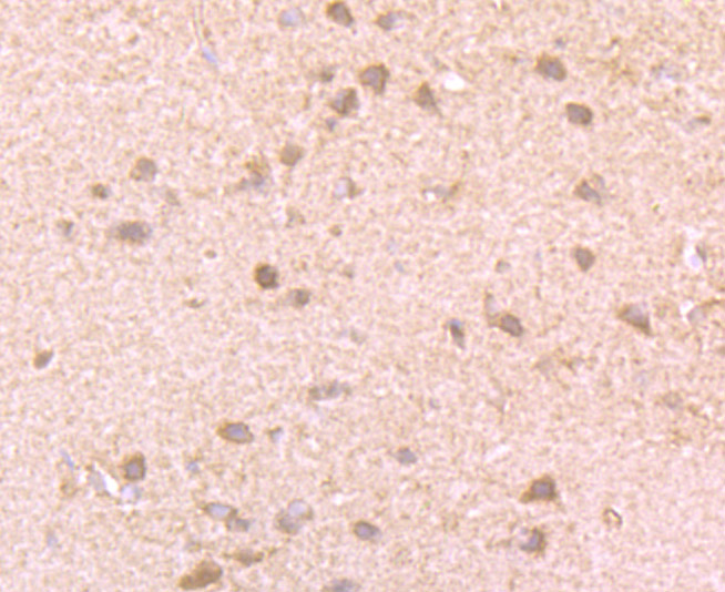 Immunohistochemical analysis of paraffin-embedded rat brain tissue using anti-GIT1 antibody. The section was pre-treated using heat mediated antigen retrieval with Tris-EDTA buffer (pH 9.0) for 20 minutes.The tissues were blocked in 1% BSA for 30 minutes at room temperature, washed with ddH2O and PBS, and then probed with the primary antibody (ET7106-91, 1/50) for 30 minutes at room temperature. The detection was performed using an HRP conjugated compact polymer system. DAB was used as the chromogen. Tissues were counterstained with hematoxylin and mounted with DPX.