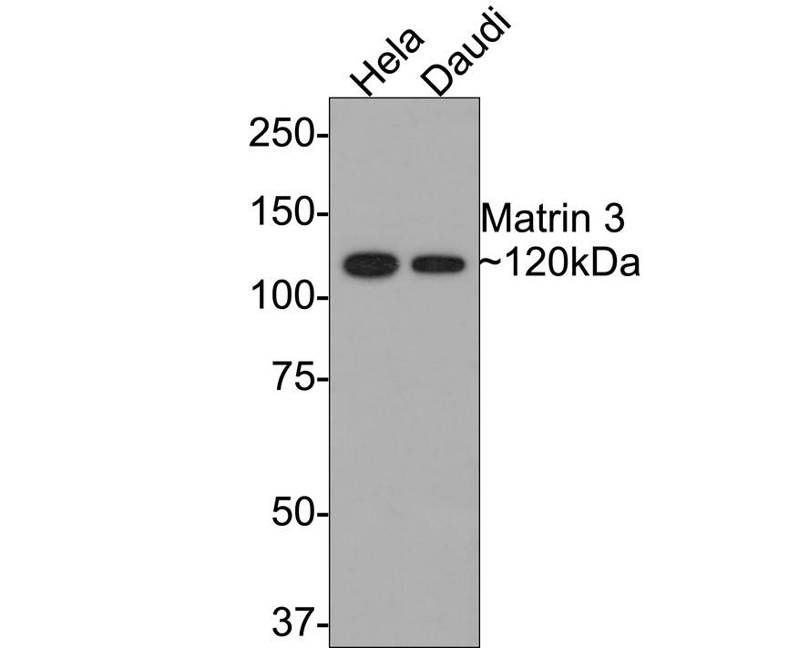 Western blot analysis of Matrin 3 on different lysates with Rabbit anti-Matrin 3 antibody (ET7106-95) at 1/500 dilution.<br />
<br />
Lane 1: Hela cell lysate<br />
Lane 2: Daudi cell lysate<br />
<br />
Lysates/proteins at 10 µg/Lane.<br />
<br />
Predicted band size: 95 kDa<br />
Observed band size: 120 kDa<br />
<br />
Exposure time: 2 minutes;<br />
<br />
8% SDS-PAGE gel.<br />
<br />
Proteins were transferred to a PVDF membrane and blocked with 5% NFDM/TBST for 1 hour at room temperature. The primary antibody (ET7106-95) at 1/500 dilution was used in 5% NFDM/TBST at room temperature for 2 hours. Goat Anti-Rabbit IgG - HRP Secondary Antibody (HA1001) at 1:300,000 dilution was used for 1 hour at room temperature.
