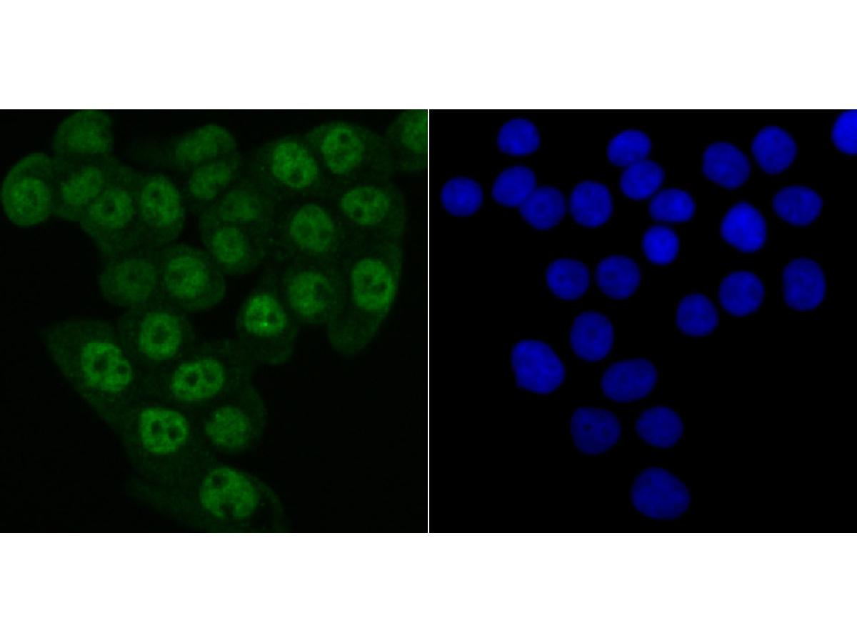 ICC staining of Matrin 3 in LOVO cells (green). Formalin fixed cells were permeabilized with 0.1% Triton X-100 in TBS for 10 minutes at room temperature and blocked with 1% Blocker BSA for 15 minutes at room temperature. Cells were probed with the primary antibody (ET7106-95, 1/50) for 1 hour at room temperature, washed with PBS. Alexa Fluor®488 Goat anti-Rabbit IgG was used as the secondary antibody at 1/1,000 dilution. The nuclear counter stain is DAPI (blue).