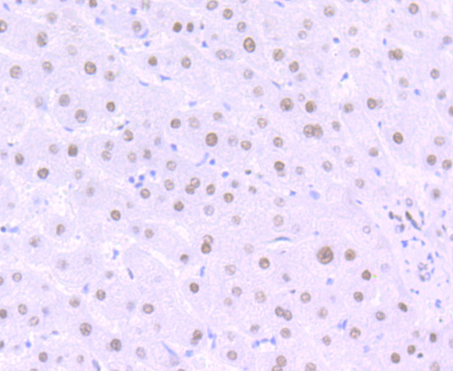 Immunohistochemical analysis of paraffin-embedded human liver tissue using anti-Matrin 3 antibody. The section was pre-treated using heat mediated antigen retrieval with Tris-EDTA buffer (pH 8.0-8.4) for 20 minutes.The tissues were blocked in 5% BSA for 30 minutes at room temperature, washed with ddH2O and PBS, and then probed with the primary antibody (ET7106-95, 1/50) for 30 minutes at room temperature. The detection was performed using an HRP conjugated compact polymer system. DAB was used as the chromogen. Tissues were counterstained with hematoxylin and mounted with DPX.