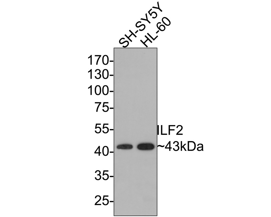 Western blot analysis of ILF2 on different lysates with Rabbit anti-ILF2 antibody (ET7106-96) at 1/500 dilution.<br />
<br />
Lane 1: SH-SY5Y cell lysate<br />
Lane 2: HL-60 cell lysate<br />
<br />
Lysates/proteins at 10 µg/Lane.<br />
<br />
Predicted band size: 43 kDa<br />
Observed band size: 43 kDa<br />
<br />
Exposure time: 1 minute;<br />
<br />
10% SDS-PAGE gel.<br />
<br />
Proteins were transferred to a PVDF membrane and blocked with 5% NFDM/TBST for 1 hour at room temperature. The primary antibody (ET7106-96) at 1/500 dilution was used in 5% NFDM/TBST at room temperature for 2 hours. Goat Anti-Rabbit IgG - HRP Secondary Antibody (HA1001) at 1:200,000 dilution was used for 1 hour at room temperature.