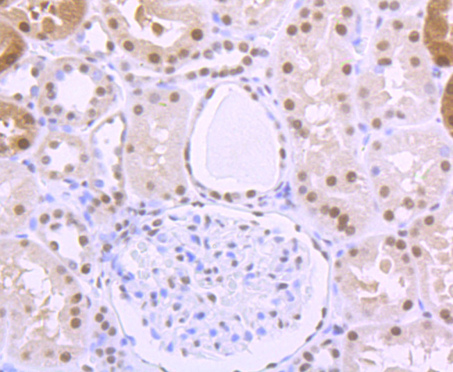 Immunohistochemical analysis of paraffin-embedded human kidney tissue using anti-ILF2 antibody. The section was pre-treated using heat mediated antigen retrieval with Tris-EDTA buffer (pH 9.0) for 20 minutes.The tissues were blocked in 1% BSA for 30 minutes at room temperature, washed with ddH2O and PBS, and then probed with the primary antibody (ET7106-96, 1/50) for 30 minutes at room temperature. The detection was performed using an HRP conjugated compact polymer system. DAB was used as the chromogen. Tissues were counterstained with hematoxylin and mounted with DPX.