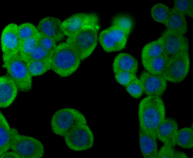 ICC staining of Fructose 6 Phosphate Kinase in PC-3M cells (green). Formalin fixed cells were permeabilized with 0.1% Triton X-100 in TBS for 10 minutes at room temperature and blocked with 1% Blocker BSA for 15 minutes at room temperature. Cells were probed with the primary antibody (ET7106-97, 1/50) for 1 hour at room temperature, washed with PBS. Alexa Fluor®488 Goat anti-Rabbit IgG was used as the secondary antibody at 1/1,000 dilution. The nuclear counter stain is DAPI (blue).