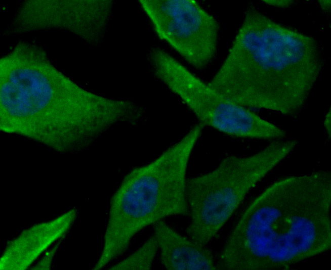 ICC staining of Fructose 6 Phosphate Kinase in SH-SY5Y cells (green). Formalin fixed cells were permeabilized with 0.1% Triton X-100 in TBS for 10 minutes at room temperature and blocked with 1% Blocker BSA for 15 minutes at room temperature. Cells were probed with the primary antibody (ET7106-97, 1/50) for 1 hour at room temperature, washed with PBS. Alexa Fluor®488 Goat anti-Rabbit IgG was used as the secondary antibody at 1/1,000 dilution. The nuclear counter stain is DAPI (blue).
