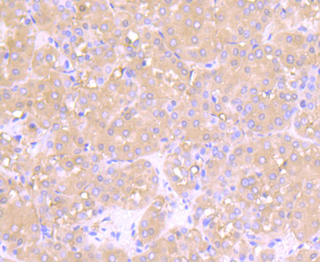 Immunohistochemical analysis of paraffin-embedded mouse skeletal muscle tissue using anti-Fructose 6 Phosphate Kinase antibody. The section was pre-treated using heat mediated antigen retrieval with Tris-EDTA buffer (pH 8.0-8.4) for 20 minutes.The tissues were blocked in 5% BSA for 30 minutes at room temperature, washed with ddH2O and PBS, and then probed with the primary antibody (ET7106-97, 1/50) for 30 minutes at room temperature. The detection was performed using an HRP conjugated compact polymer system. DAB was used as the chromogen. Tissues were counterstained with hematoxylin and mounted with DPX.