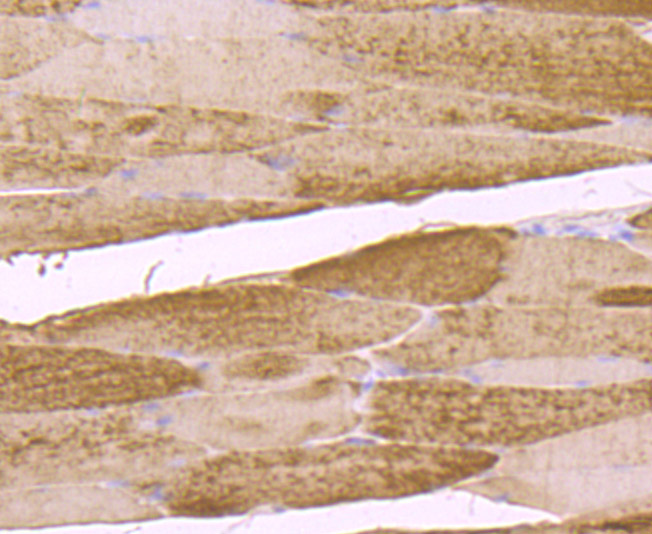 Immunohistochemical analysis of paraffin-embedded human thyroid tissue using anti-Fructose 6 Phosphate Kinase antibody. The section was pre-treated using heat mediated antigen retrieval with Tris-EDTA buffer (pH 8.0-8.4) for 20 minutes.The tissues were blocked in 5% BSA for 30 minutes at room temperature, washed with ddH2O and PBS, and then probed with the primary antibody (ET7106-97, 1/50) for 30 minutes at room temperature. The detection was performed using an HRP conjugated compact polymer system. DAB was used as the chromogen. Tissues were counterstained with hematoxylin and mounted with DPX.
