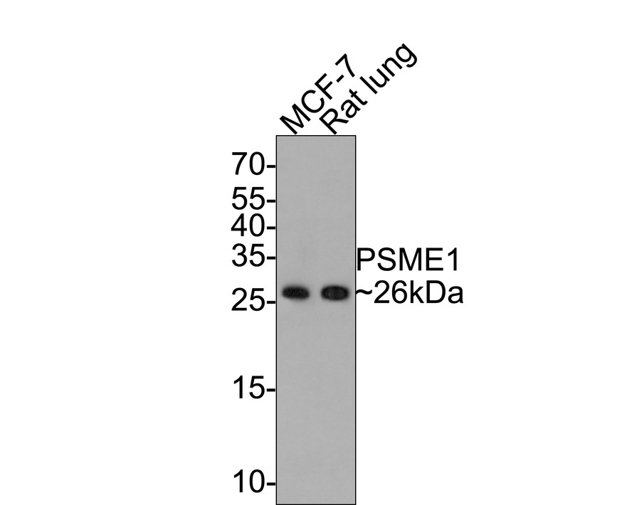 Western blot analysis of PSME1 on different lysates with Rabbit anti-PSME1 antibody (ET7106-98) at 1/500 dilution.<br />
<br />
Lane 1: MCF-7 cell lysate<br />
Lane 2: Rat lung tissue lysate (20 µg/Lane)<br />
<br />
Lysates/proteins at 10 µg/Lane.<br />
<br />
Predicted band size: 29 kDa<br />
Observed band size: 26 kDa<br />
<br />
Exposure time: 2 minutes;<br />
<br />
15% SDS-PAGE gel.<br />
<br />
Proteins were transferred to a PVDF membrane and blocked with 5% NFDM/TBST for 1 hour at room temperature. The primary antibody (ET7106-98) at 1/500 dilution was used in 5% NFDM/TBST at room temperature for 2 hours. Goat Anti-Rabbit IgG - HRP Secondary Antibody (HA1001) at 1:200,000 dilution was used for 1 hour at room temperature.