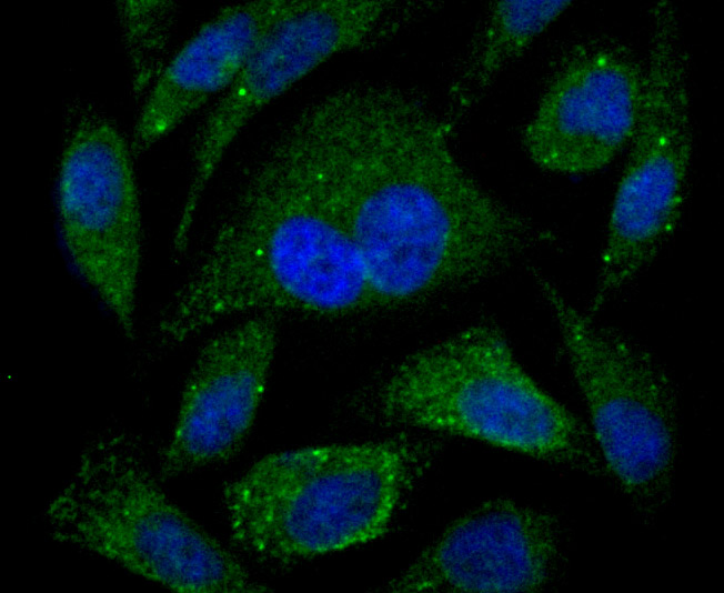 ICC staining of PSME1 in PC-3M cells (green). Formalin fixed cells were permeabilized with 0.1% Triton X-100 in TBS for 10 minutes at room temperature and blocked with 10% negative goat serum for 15 minutes at room temperature. Cells were probed with the primary antibody (ET7106-98, 1/50) for 1 hour at room temperature, washed with PBS. Alexa Fluor®488 conjugate-Goat anti-Rabbit IgG was used as the secondary antibody at 1/1,000 dilution. The nuclear counter stain is DAPI (blue).