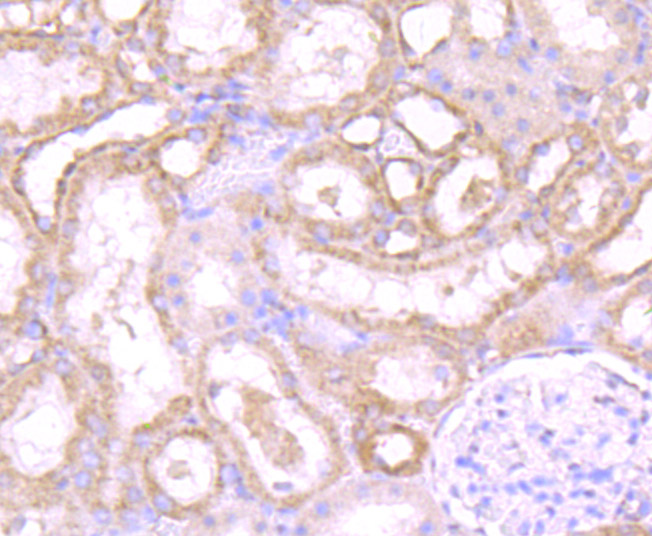 Immunohistochemical analysis of paraffin-embedded rat kidney tissue using anti-PSME1 antibody. The section was pre-treated using heat mediated antigen retrieval with Tris-EDTA buffer (pH 9.0) for 20 minutes.The tissues were blocked in 1% BSA for 30 minutes at room temperature, washed with ddH2O and PBS, and then probed with the primary antibody (ET7106-98, 1/50) for 30 minutes at room temperature. The detection was performed using an HRP conjugated compact polymer system. DAB was used as the chromogen. Tissues were counterstained with hematoxylin and mounted with DPX.