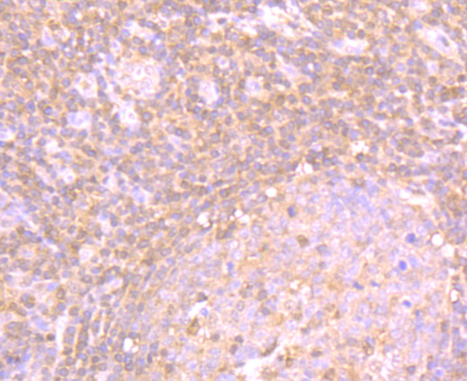 Immunohistochemical analysis of paraffin-embedded human tonsil tissue using anti-PSME1 antibody. The section was pre-treated using heat mediated antigen retrieval with Tris-EDTA buffer (pH 9.0) for 20 minutes.The tissues were blocked in 1% BSA for 30 minutes at room temperature, washed with ddH2O and PBS, and then probed with the primary antibody (ET7106-98, 1/50) for 30 minutes at room temperature. The detection was performed using an HRP conjugated compact polymer system. DAB was used as the chromogen. Tissues were counterstained with hematoxylin and mounted with DPX.