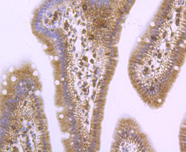 Immunohistochemical analysis of paraffin-embedded mouse small intestine tissue using anti-PSME1 antibody. The section was pre-treated using heat mediated antigen retrieval with Tris-EDTA buffer (pH 9.0) for 20 minutes.The tissues were blocked in 1% BSA for 30 minutes at room temperature, washed with ddH2O and PBS, and then probed with the primary antibody (ET7106-98, 1/50) for 30 minutes at room temperature. The detection was performed using an HRP conjugated compact polymer system. DAB was used as the chromogen. Tissues were counterstained with hematoxylin and mounted with DPX.