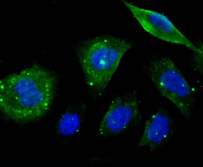 ICC staining EB3 in PC-3M cells (green). The nuclear counter stain is DAPI (blue). Cells were fixed in paraformaldehyde, permeabilised with 0.25% Triton X100/PBS.