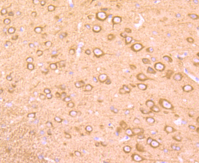 Immunohistochemical analysis of paraffin-embedded mouse brain tissue using anti-EB3 antibody. Counter stained with hematoxylin.