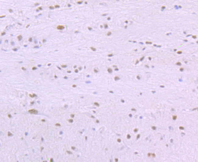 Immunohistochemical analysis of paraffin-embedded rat brain tissue using anti-SF3B1 antibody. The section was pre-treated using heat mediated antigen retrieval with Tris-EDTA buffer (pH 9.0) for 20 minutes.The tissues were blocked in 1% BSA for 30 minutes at room temperature, washed with ddH2O and PBS, and then probed with the primary antibody (ET7107-03, 1/50) for 30 minutes at room temperature. The detection was performed using an HRP conjugated compact polymer system. DAB was used as the chromogen. Tissues were counterstained with hematoxylin and mounted with DPX.