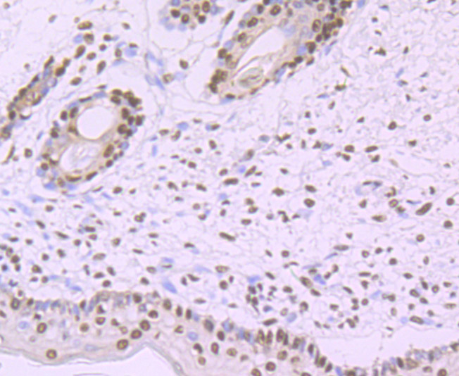 Immunohistochemical analysis of paraffin-embedded human skin tissue using anti-SF3B1 antibody. The section was pre-treated using heat mediated antigen retrieval with Tris-EDTA buffer (pH 9.0) for 20 minutes.The tissues were blocked in 1% BSA for 30 minutes at room temperature, washed with ddH2O and PBS, and then probed with the primary antibody (ET7107-03, 1/50) for 30 minutes at room temperature. The detection was performed using an HRP conjugated compact polymer system. DAB was used as the chromogen. Tissues were counterstained with hematoxylin and mounted with DPX.