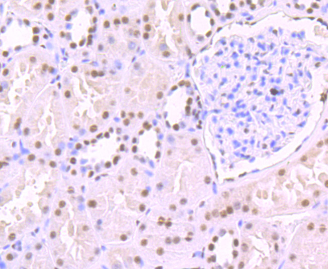 Immunohistochemical analysis of paraffin-embedded human kidney tissue using anti-SF3B1 antibody. The section was pre-treated using heat mediated antigen retrieval with Tris-EDTA buffer (pH 9.0) for 20 minutes.The tissues were blocked in 1% BSA for 30 minutes at room temperature, washed with ddH2O and PBS, and then probed with the primary antibody (ET7107-03, 1/50) for 30 minutes at room temperature. The detection was performed using an HRP conjugated compact polymer system. DAB was used as the chromogen. Tissues were counterstained with hematoxylin and mounted with DPX.