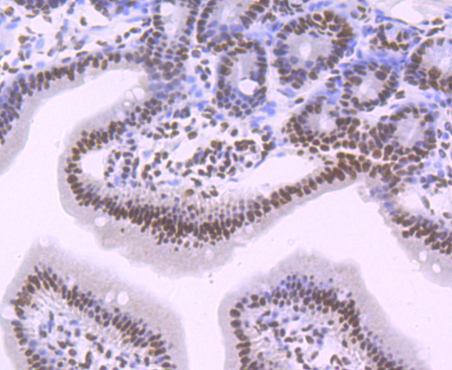 Immunohistochemical analysis of paraffin-embedded mouse small intestine tissue using anti-SF3B1 antibody. The section was pre-treated using heat mediated antigen retrieval with Tris-EDTA buffer (pH 9.0) for 20 minutes.The tissues were blocked in 1% BSA for 30 minutes at room temperature, washed with ddH2O and PBS, and then probed with the primary antibody (ET7107-03, 1/50) for 30 minutes at room temperature. The detection was performed using an HRP conjugated compact polymer system. DAB was used as the chromogen. Tissues were counterstained with hematoxylin and mounted with DPX.