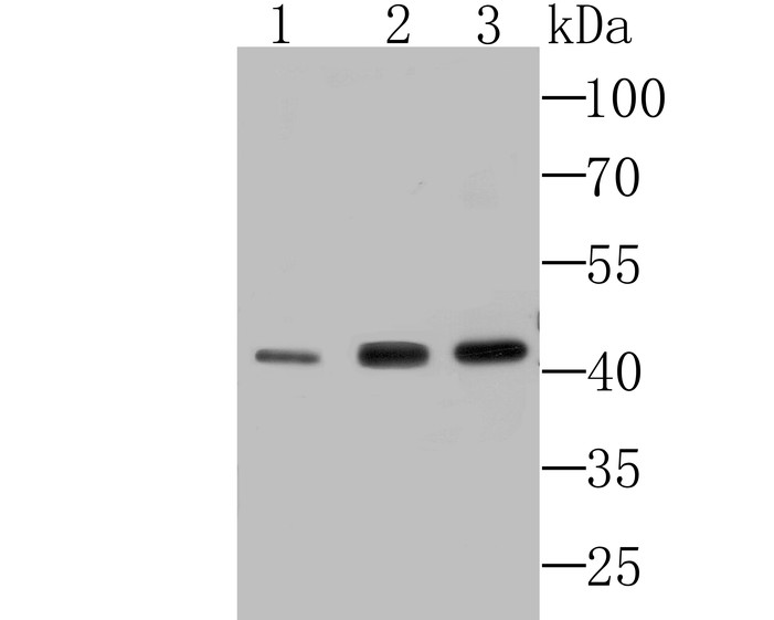 Western blot analysis of Septin 2 on different lysates. Proteins were transferred to a PVDF membrane and blocked with 5% BSA in PBS for 1 hour at room temperature. The primary antibody (ET7107-05, 1/500) was used in 5% BSA at room temperature for 2 hours. Goat Anti-Rabbit IgG - HRP Secondary Antibody (HA1001) at 1:200,000 dilution was used for 1 hour at room temperature.<br />
Positive control: <br />
Lane 1: Mouse brain tissue lysate<br />
Lane 2: SiHa cell lysate<br />
Lane 3: K562 cell lysate<br />
<br />
Predicted band size: 41 kDa<br />
Observed band size: 41 kDa