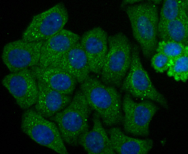 ICC staining of Septin 2 in HepG2 cells (green). Formalin fixed cells were permeabilized with 0.1% Triton X-100 in TBS for 10 minutes at room temperature and blocked with 10% negative goat serum for 15 minutes at room temperature. Cells were probed with the primary antibody (ET7107-05, 1/50) for 1 hour at room temperature, washed with PBS. Alexa Fluor®488 conjugate-Goat anti-Rabbit IgG was used as the secondary antibody at 1/1,000 dilution. The nuclear counter stain is DAPI (blue).