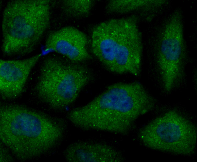 ICC staining of Septin 2 in HUVEC cells (green). Formalin fixed cells were permeabilized with 0.1% Triton X-100 in TBS for 10 minutes at room temperature and blocked with 10% negative goat serum for 15 minutes at room temperature. Cells were probed with the primary antibody (ET7107-05, 1/50) for 1 hour at room temperature, washed with PBS. Alexa Fluor®488 conjugate-Goat anti-Rabbit IgG was used as the secondary antibody at 1/1,000 dilution. The nuclear counter stain is DAPI (blue).