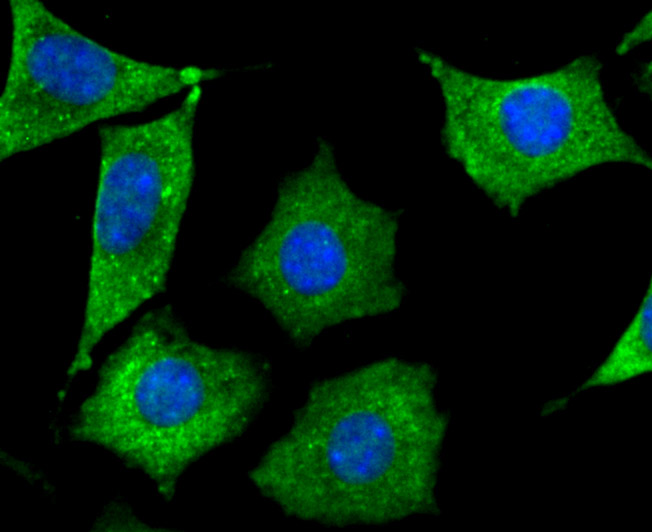 ICC staining of Septin 2 in SH-SY5Y cells (green). Formalin fixed cells were permeabilized with 0.1% Triton X-100 in TBS for 10 minutes at room temperature and blocked with 10% negative goat serum for 15 minutes at room temperature. Cells were probed with the primary antibody (ET7107-05, 1/50) for 1 hour at room temperature, washed with PBS. Alexa Fluor®488 conjugate-Goat anti-Rabbit IgG was used as the secondary antibody at 1/1,000 dilution. The nuclear counter stain is DAPI (blue).