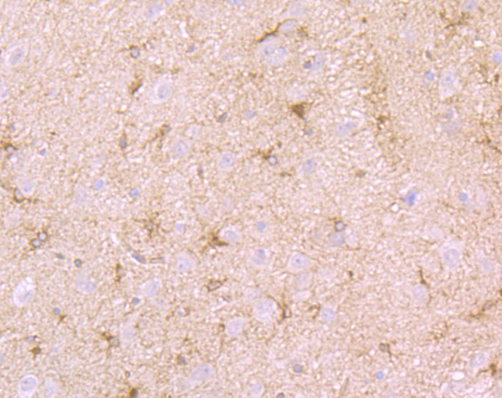 Immunohistochemical analysis of paraffin-embedded rat brain tissue using anti-Septin 2 antibody. The section was pre-treated using heat mediated antigen retrieval with Tris-EDTA buffer (pH 9.0) for 20 minutes.The tissues were blocked in 1% BSA for 30 minutes at room temperature, washed with ddH2O and PBS, and then probed with the primary antibody (ET7107-05, 1/50) for 30 minutes at room temperature. The detection was performed using an HRP conjugated compact polymer system. DAB was used as the chromogen. Tissues were counterstained with hematoxylin and mounted with DPX.