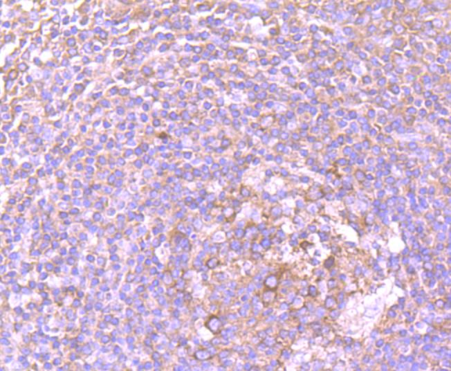 Immunohistochemical analysis of paraffin-embedded human tonsil tissue using anti-DDX6 antibody. Counter stained with hematoxylin.