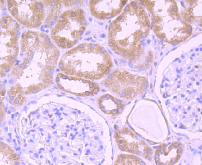 Immunohistochemical analysis of paraffin-embedded human kidney tissue using anti-DDX6 antibody. Counter stained with hematoxylin.