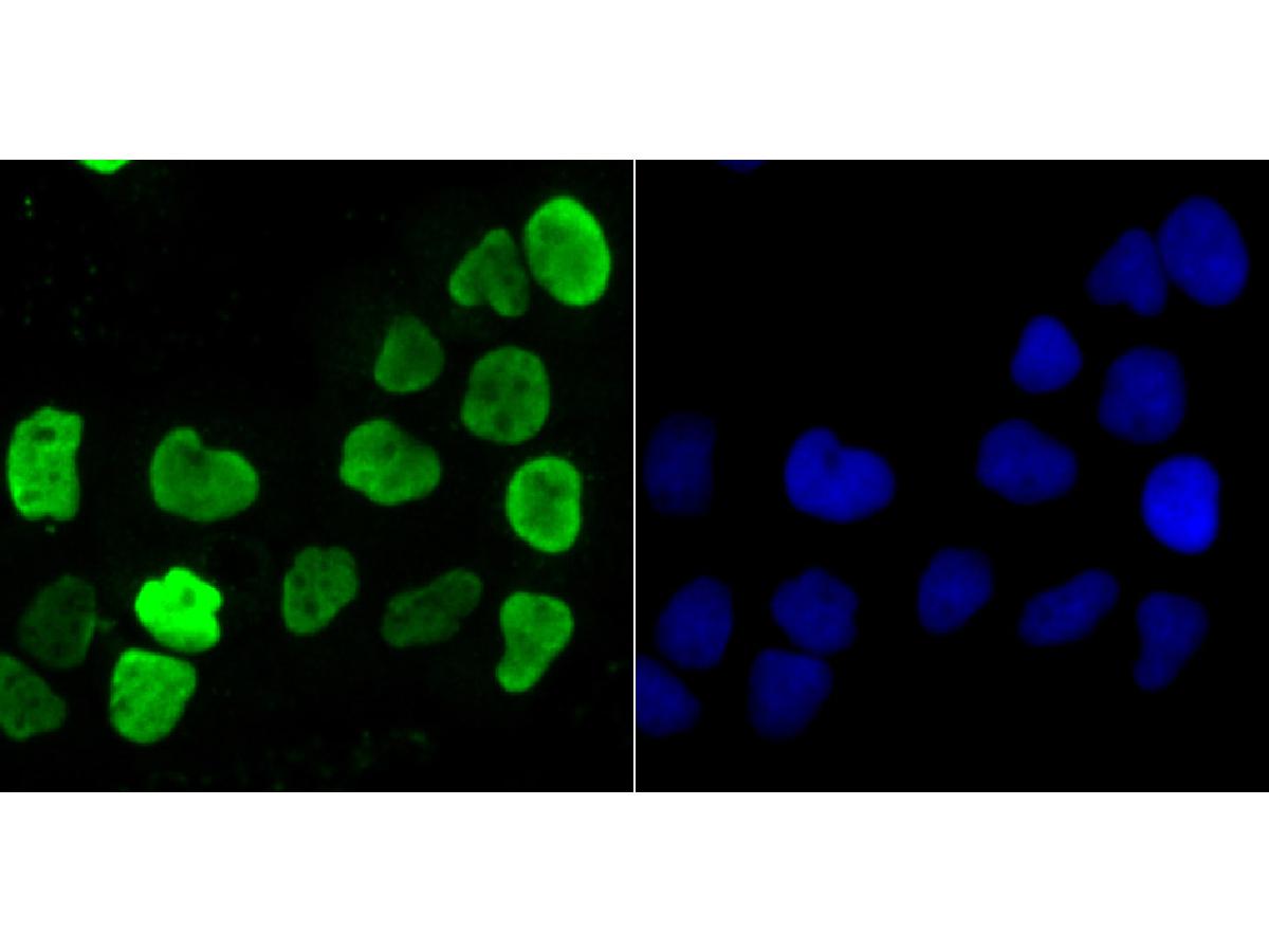 ICC staining of hnRNP U in A431 cells (green). Formalin fixed cells were permeabilized with 0.1% Triton X-100 in TBS for 10 minutes at room temperature and blocked with 10% negative goat serum for 15 minutes at room temperature. Cells were probed with the primary antibody (ET7107-10, 1/50) for 1 hour at room temperature, washed with PBS. Alexa Fluor®488 conjugate-Goat anti-Rabbit IgG was used as the secondary antibody at 1/1,000 dilution. The nuclear counter stain is DAPI (blue).