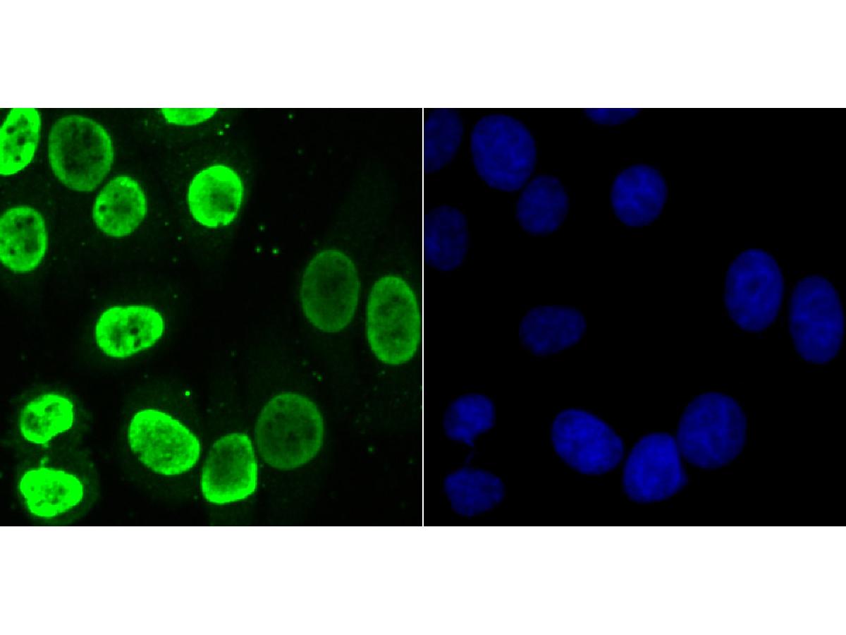 ICC staining of hnRNP U in HepG2 cells (green). Formalin fixed cells were permeabilized with 0.1% Triton X-100 in TBS for 10 minutes at room temperature and blocked with 10% negative goat serum for 15 minutes at room temperature. Cells were probed with the primary antibody (ET7107-10, 1/50) for 1 hour at room temperature, washed with PBS. Alexa Fluor®488 conjugate-Goat anti-Rabbit IgG was used as the secondary antibody at 1/1,000 dilution. The nuclear counter stain is DAPI (blue).