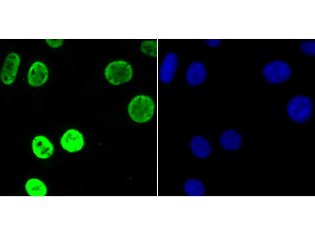 ICC staining of hnRNP U in SH-SY5Y cells (green). Formalin fixed cells were permeabilized with 0.1% Triton X-100 in TBS for 10 minutes at room temperature and blocked with 10% negative goat serum for 15 minutes at room temperature. Cells were probed with the primary antibody (ET7107-10, 1/50) for 1 hour at room temperature, washed with PBS. Alexa Fluor®488 conjugate-Goat anti-Rabbit IgG was used as the secondary antibody at 1/1,000 dilution. The nuclear counter stain is DAPI (blue).