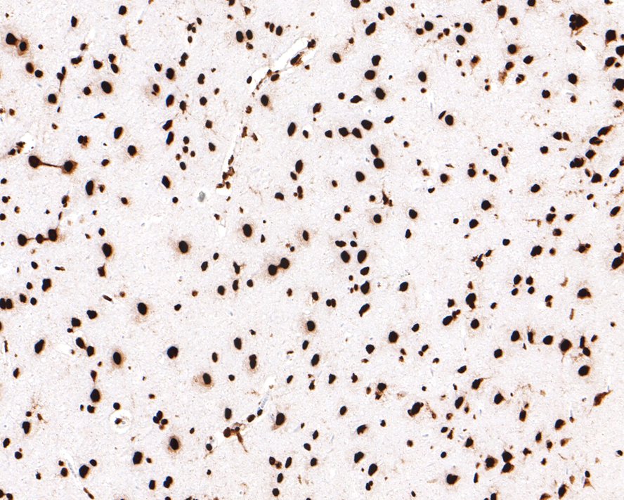 Immunohistochemical analysis of paraffin-embedded rat brain tissue with Rabbit anti-hnRNP U antibody (ET7107-10) at 1/400 dilution.<br />
<br />
The section was pre-treated using heat mediated antigen retrieval with sodium citrate buffer (pH 6.0) for 2 minutes. The tissues were blocked in 1% BSA for 20 minutes at room temperature, washed with ddH2O and PBS, and then probed with the primary antibody (ET7107-10) at 1/400 dilution for 1 hour at room temperature. The detection was performed using an HRP conjugated compact polymer system. DAB was used as the chromogen. Tissues were counterstained with hematoxylin and mounted with DPX.