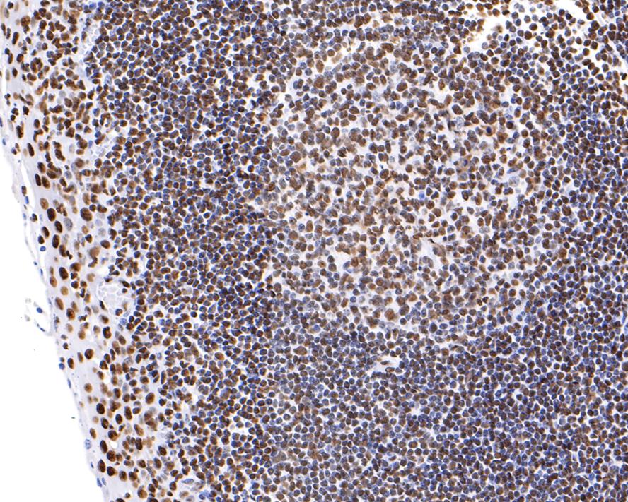 Immunohistochemical analysis of paraffin-embedded human tonsil tissue with Rabbit anti-hnRNP U antibody (ET7107-10) at 1/200 dilution.<br />
<br />
The section was pre-treated using heat mediated antigen retrieval with sodium citrate buffer (pH 6.0) for 2 minutes. The tissues were blocked in 1% BSA for 20 minutes at room temperature, washed with ddH2O and PBS, and then probed with the primary antibody (ET7107-10) at 1/200 dilution for 1 hour at room temperature. The detection was performed using an HRP conjugated compact polymer system. DAB was used as the chromogen. Tissues were counterstained with hematoxylin and mounted with DPX.