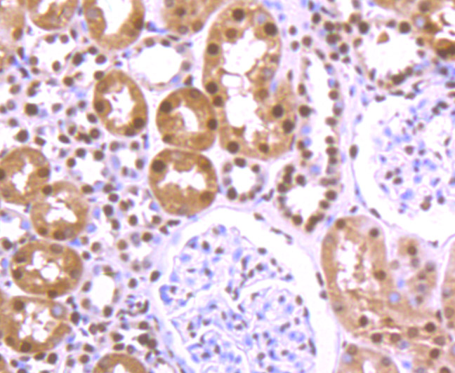Immunohistochemical analysis of paraffin-embedded human kidney tissue using anti-hnRNP U antibody. The section was pre-treated using heat mediated antigen retrieval with Tris-EDTA buffer (pH 9.0) for 20 minutes.The tissues were blocked in 1% BSA for 30 minutes at room temperature, washed with ddH2O and PBS, and then probed with the primary antibody (ET7107-10, 1/50) for 30 minutes at room temperature. The detection was performed using an HRP conjugated compact polymer system. DAB was used as the chromogen. Tissues were counterstained with hematoxylin and mounted with DPX.