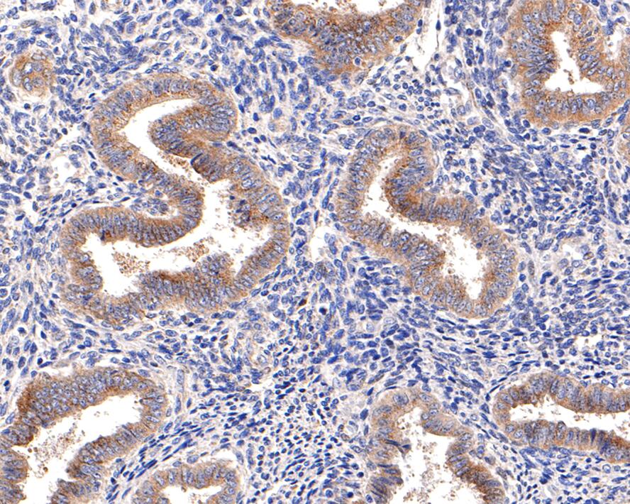 Immunohistochemical analysis of paraffin-embedded human uterus tissue with Rabbit anti-GRASP65 antibody (ET7107-13) at 1/100 dilution.<br />
<br />
The section was pre-treated using heat mediated antigen retrieval with Tris-EDTA buffer (pH 9.0) for 20 minutes. The tissues were blocked in 1% BSA for 20 minutes at room temperature, washed with ddH2O and PBS, and then probed with the primary antibody (ET7107-13) at 1/100 dilution for 1 hour at room temperature. The detection was performed using an HRP conjugated compact polymer system. DAB was used as the chromogen. Tissues were counterstained with hematoxylin and mounted with DPX.