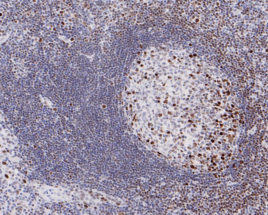 Immunohistochemical analysis of paraffin-embedded human tonsil tissue with Rabbit anti-DNA Ligase I antibody (ET7107-14) at 1/200 dilution.<br />
<br />
The section was pre-treated using heat mediated antigen retrieval with sodium citrate buffer (pH 6.0) for 2 minutes. The tissues were blocked in 1% BSA for 20 minutes at room temperature, washed with ddH2O and PBS, and then probed with the primary antibody (ET7107-14) at 1/200 dilution for 1 hour at room temperature. The detection was performed using an HRP conjugated compact polymer system. DAB was used as the chromogen. Tissues were counterstained with hematoxylin and mounted with DPX.