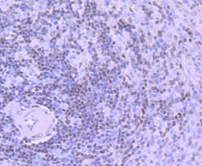 Immunohistochemical analysis of paraffin-embedded human spleen tissue with Rabbit anti-DNA Ligase I antibody (ET7107-14) at 1/200 dilution.<br />
<br />
The section was pre-treated using heat mediated antigen retrieval with sodium citrate buffer (pH 6.0) for 2 minutes. The tissues were blocked in 1% BSA for 20 minutes at room temperature, washed with ddH2O and PBS, and then probed with the primary antibody (ET7107-14) at 1/200 dilution for 1 hour at room temperature. The detection was performed using an HRP conjugated compact polymer system. DAB was used as the chromogen. Tissues were counterstained with hematoxylin and mounted with DPX.