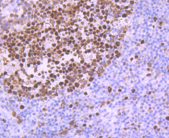 Immunohistochemical analysis of paraffin-embedded human tonsil tissue using anti-MCM5 antibody. The section was pre-treated using heat mediated antigen retrieval with Tris-EDTA buffer (pH 9.0) for 20 minutes.The tissues were blocked in 1% BSA for 30 minutes at room temperature, washed with ddH2O and PBS, and then probed with the primary antibody (ET7107-15, 1/50) for 30 minutes at room temperature. The detection was performed using an HRP conjugated compact polymer system. DAB was used as the chromogen. Tissues were counterstained with hematoxylin and mounted with DPX.