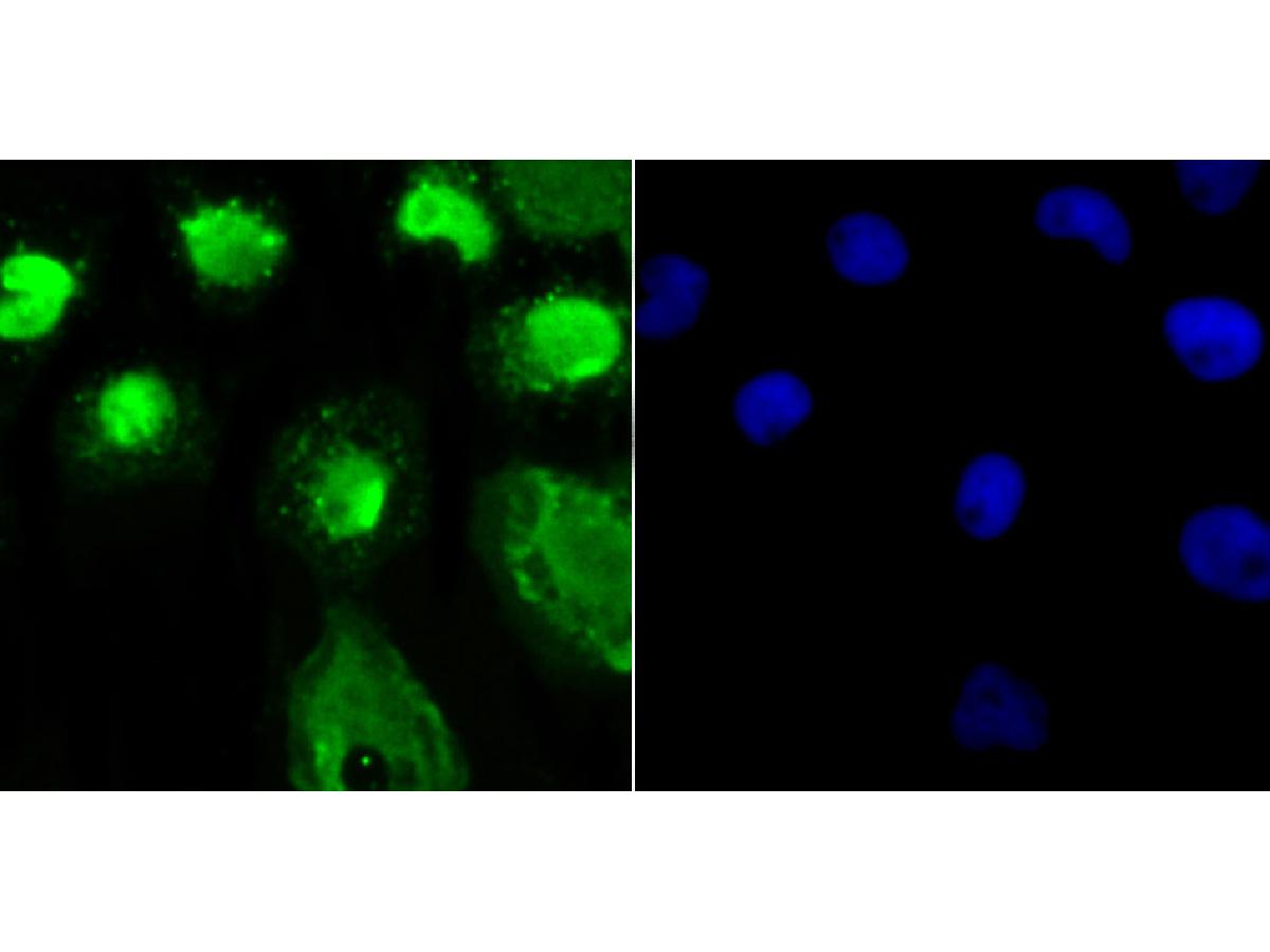 ICC staining OGT in A431 cells (green). The nuclear counter stain is DAPI (blue). Cells were fixed in paraformaldehyde, permeabilised with 0.25% Triton X100/PBS.