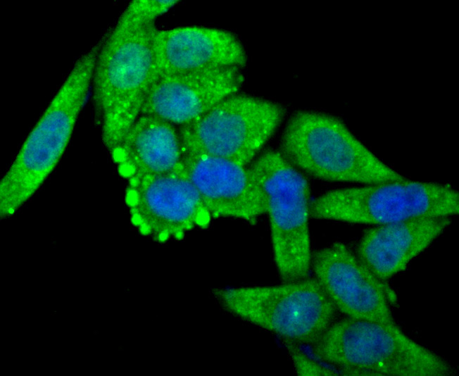 ICC staining OGT in Hela cells (green). The nuclear counter stain is DAPI (blue). Cells were fixed in paraformaldehyde, permeabilised with 0.25% Triton X100/PBS.