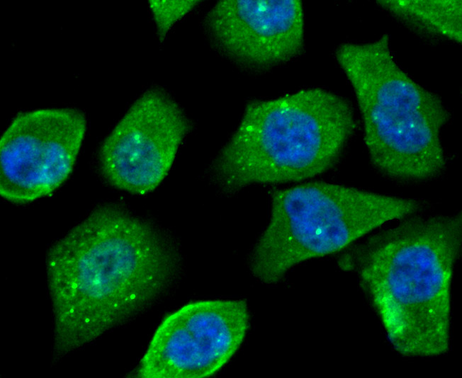 ICC staining OGT in PC-3M cells (green). The nuclear counter stain is DAPI (blue). Cells were fixed in paraformaldehyde, permeabilised with 0.25% Triton X100/PBS.