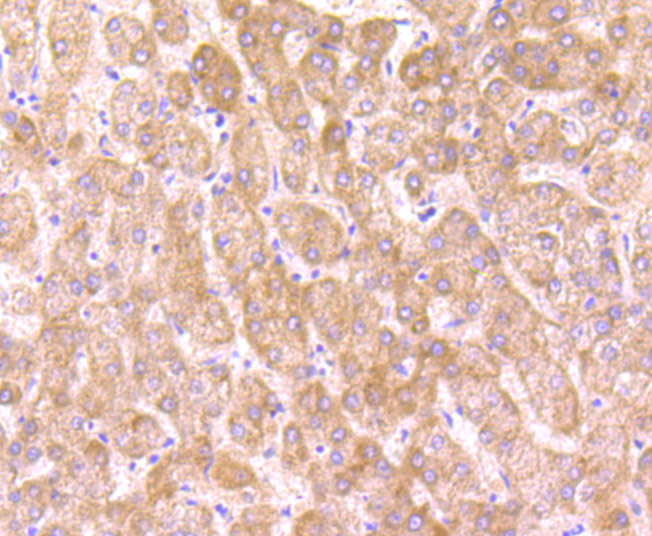 Immunohistochemical analysis of paraffin-embedded human liver tissue using anti-OGT antibody. Counter stained with hematoxylin.