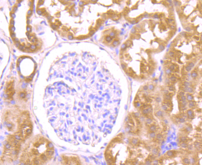 Immunohistochemical analysis of paraffin-embedded human kidney tissue using anti-OGT antibody. Counter stained with hematoxylin.