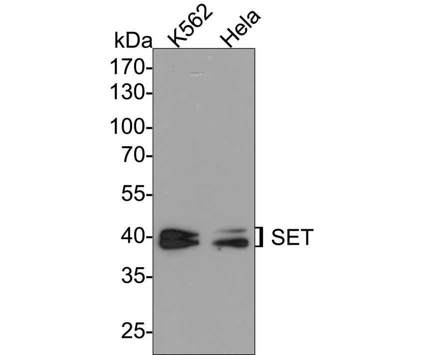 Western blot analysis of SET on K562 cell lysates. Proteins were transferred to a PVDF membrane and blocked with 5% BSA in PBS for 1 hour at room temperature. The primary antibody (ET7107-18, 1/500) was used in 5% BSA at room temperature for 2 hours. Goat Anti-Rabbit IgG - HRP Secondary Antibody (HA1001) at 1:200,000 dilution was used for 1 hour at room temperature.