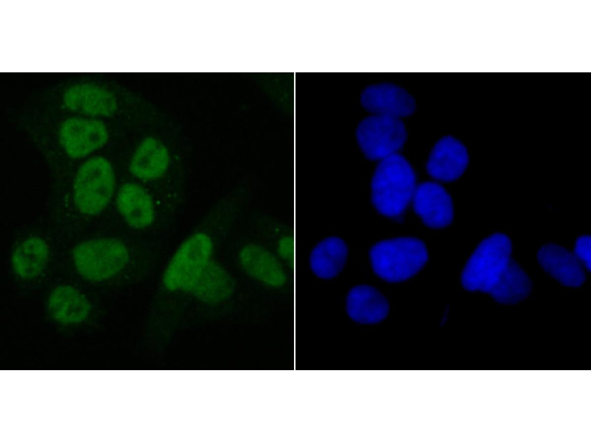 ICC staining of SET in Hela cells (green). Formalin fixed cells were permeabilized with 0.1% Triton X-100 in TBS for 10 minutes at room temperature and blocked with 1% Blocker BSA for 15 minutes at room temperature. Cells were probed with the primary antibody (ET7107-18, 1/50) for 1 hour at room temperature, washed with PBS. Alexa Fluor®488 Goat anti-Rabbit IgG was used as the secondary antibody at 1/1,000 dilution. The nuclear counter stain is DAPI (blue).