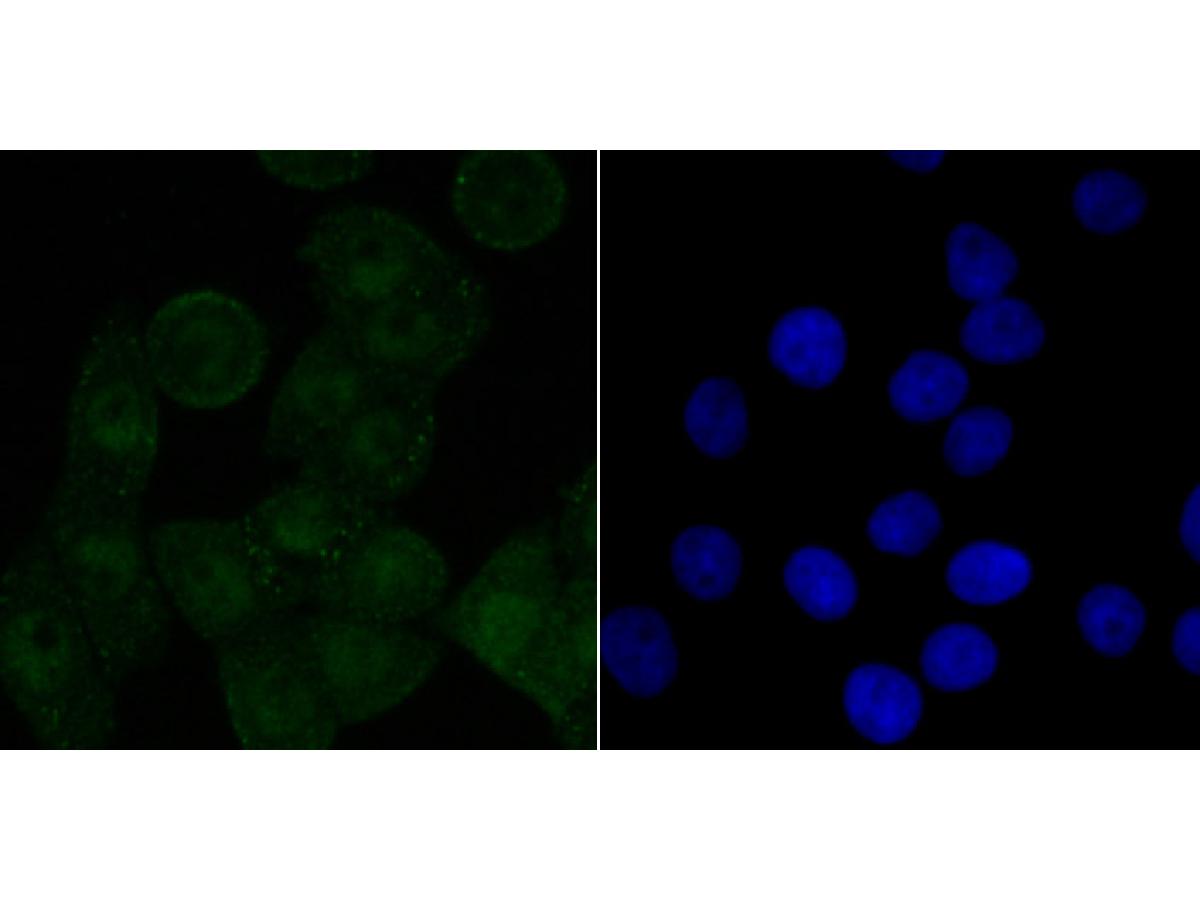 ICC staining of SET in LOVO cells (green). Formalin fixed cells were permeabilized with 0.1% Triton X-100 in TBS for 10 minutes at room temperature and blocked with 1% Blocker BSA for 15 minutes at room temperature. Cells were probed with the primary antibody (ET7107-18, 1/50) for 1 hour at room temperature, washed with PBS. Alexa Fluor®488 Goat anti-Rabbit IgG was used as the secondary antibody at 1/1,000 dilution. The nuclear counter stain is DAPI (blue).
